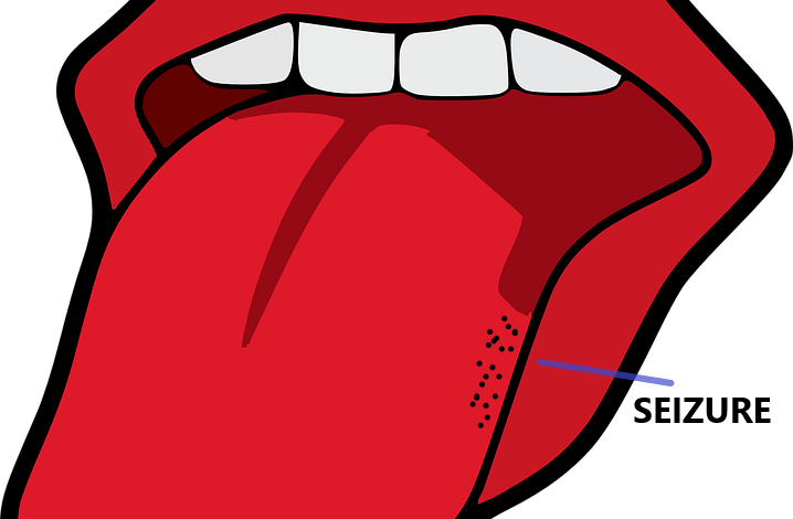 Tongue bite seizure