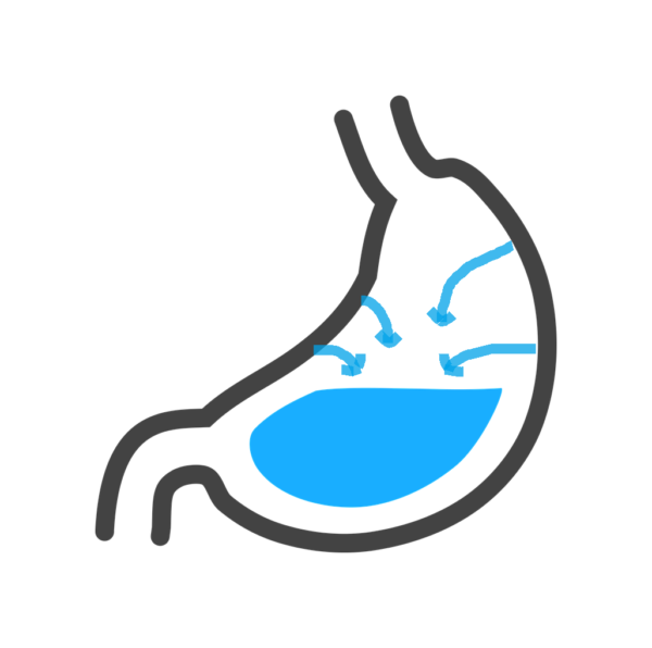 acid rebound PPIs