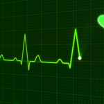 EKG in DKA