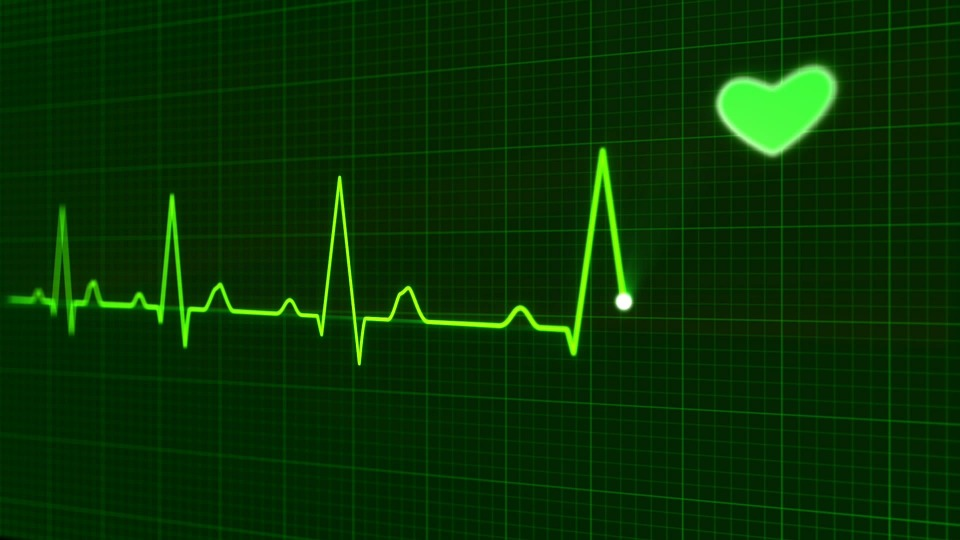 EKG in DKA