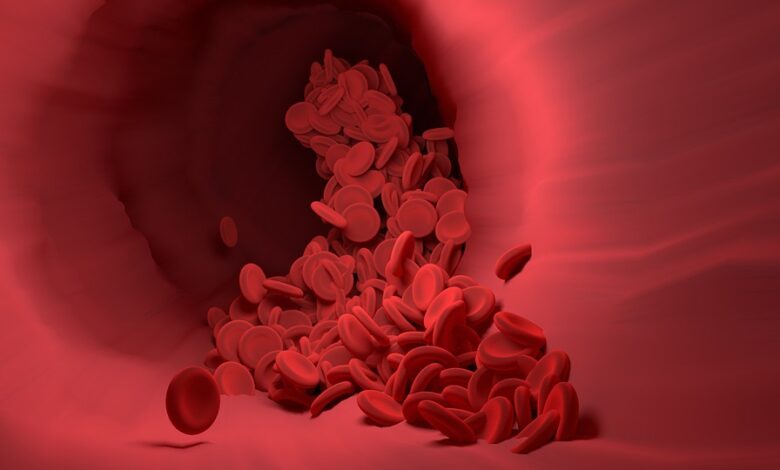 Hemoglobin versus Hematocrit