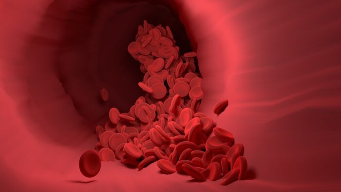 Hemoglobin versus Hematocrit