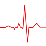 Premature Atrial Contraction