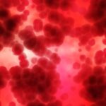 Anemia in GI bleed