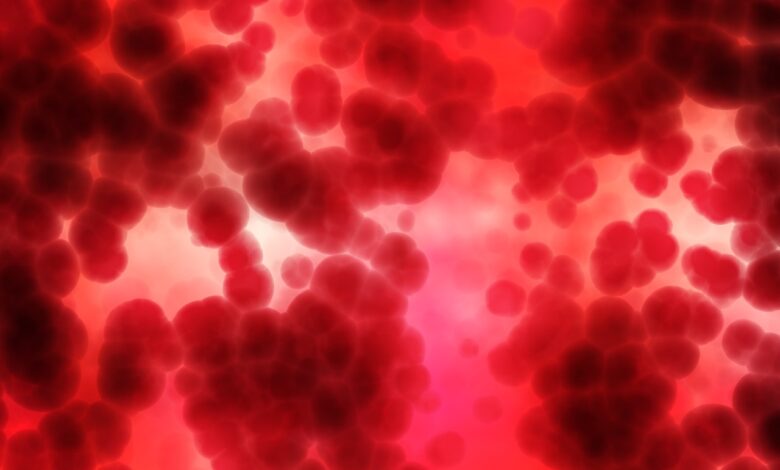 Anemia in GI bleed