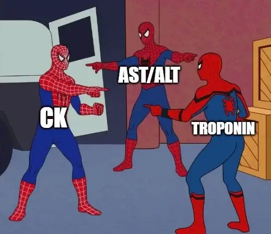 AST ALT connection with CK and Troponin